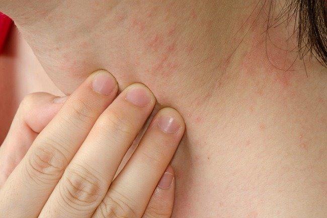 Qui connaît un bon dermato pour calmer un psoriasis ? Un dermato qui va me prescrire autre chose que de simples crèmes qui ne sont pas efficaces...