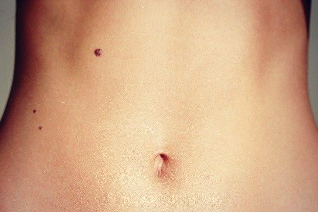 Qui connaît un bon chirurgien plastique pour enlever un grain de beauté en région verviétoise ou liégeoise ? Quelqu'un de compétent et de rassurant.